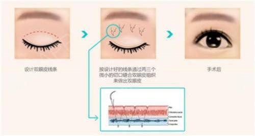 青岛南海妙华美医疗美容诊所详细的预约挂号方式及流程