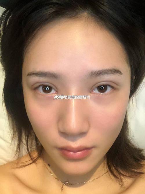 青岛南海妙华美医疗美容诊所真人口碑评价怎么样？