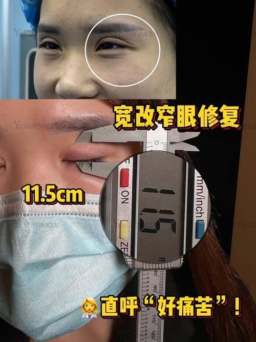 重庆圣熙整形医院详细的预约挂号方式及流程