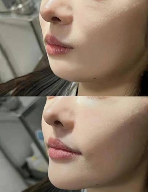 重庆圣熙整形医院是正规医院吗？