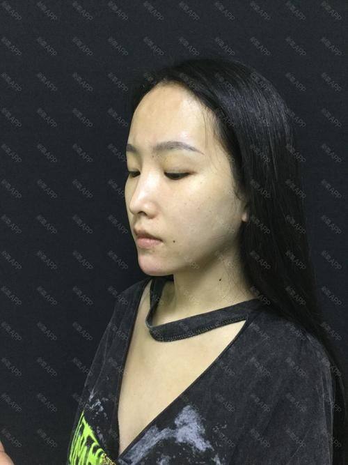 青岛南海妙华美医疗美容诊所特色项目及技术优势