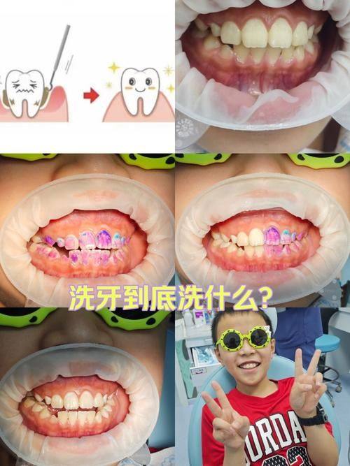 昆明华美美莱口腔门诊部地址电话营业时间