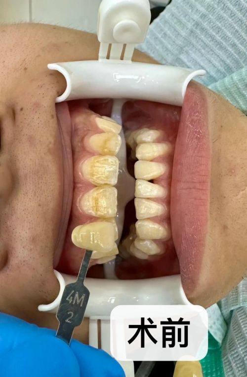 昆明华美美莱口腔门诊部详细的预约挂号方式及流程