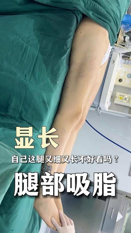 郑州艺美千嘉延丽美容整形医院收费价格表/收费标准