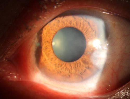 信阳市中 心医院眼科特色项目及技术优势