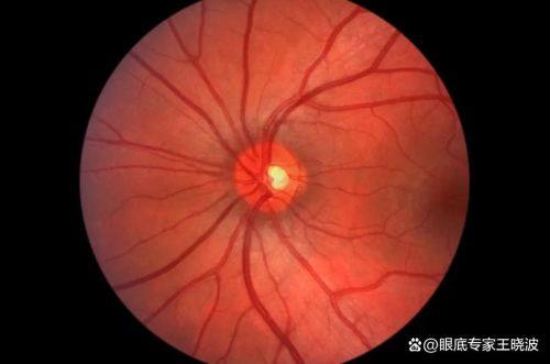 信阳市中 心医院眼科收费价格表/收费标准