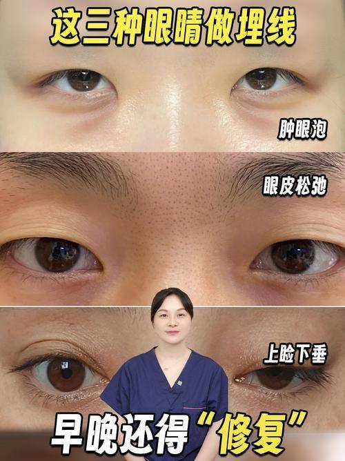 郑州艺美千嘉延丽美容整形医院是正规医院吗？