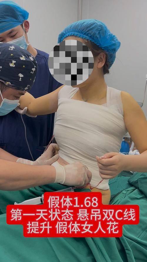 郑州艺美千嘉延丽美容整形医院真人口碑评价怎么样？