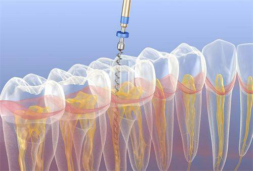 上饶信州区郭芳庆口腔诊所特色项目及技术优势