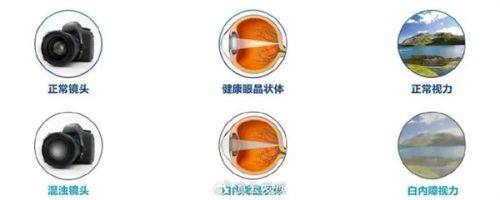 北流市人民医院眼科特色项目及技术优势