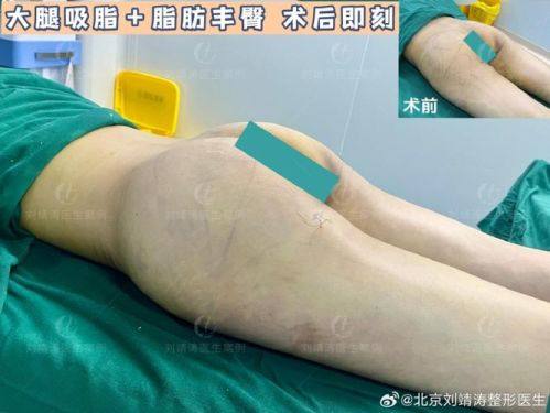 湖州解放军第98医院整形美容中 心是正规医院吗？