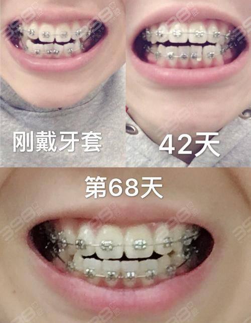 上饶信州区郭芳庆口腔诊所收费价格表/收费标准