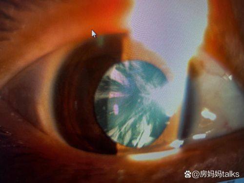 北流市人民医院眼科详细的预约挂号方式及流程