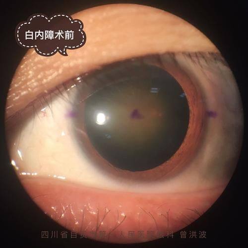 北流市人民医院眼科医生团队实力强大及骨干医生简介