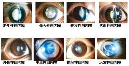 北流市人民医院眼科真人口碑评价怎么样？