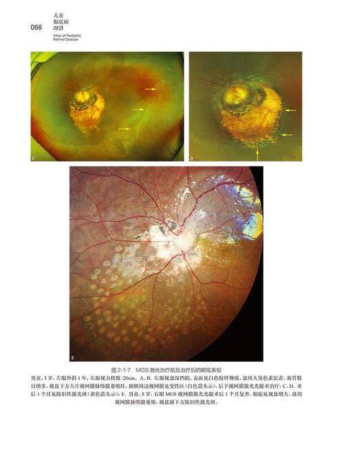 吉林省人民医院眼科详细的预约挂号方式及流程