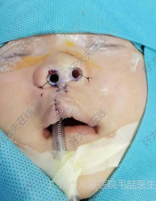 湖州解放军第98医院整形美容中 心医生团队实力强大及骨干医生简介