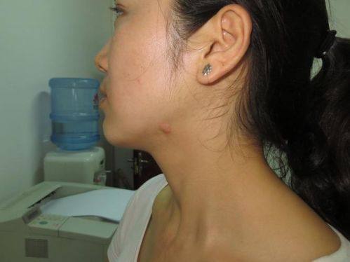 湖州解放军第98医院整形美容中 心详细的预约挂号方式及流程