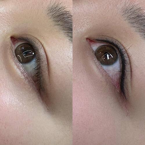 临沂美希整形医院特色项目及技术优势