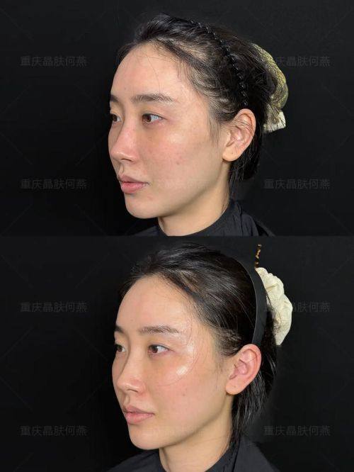 临沂美希整形医院真人口碑评价怎么样？