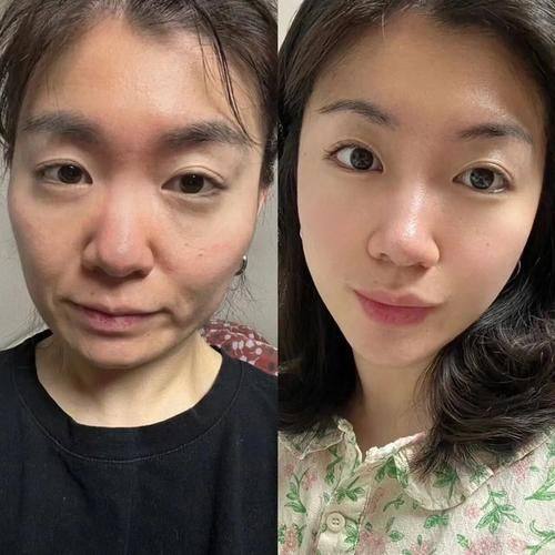 emediline皮肤科详细的预约挂号方式及流程