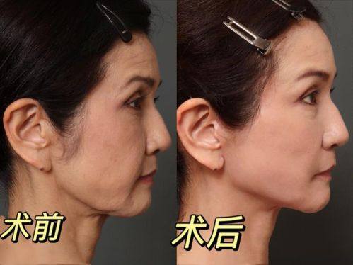 emediline皮肤科收费价格表/收费标准