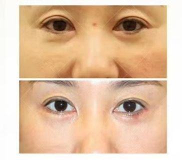 昆明大华医疗整形美容医院是正规医院吗？