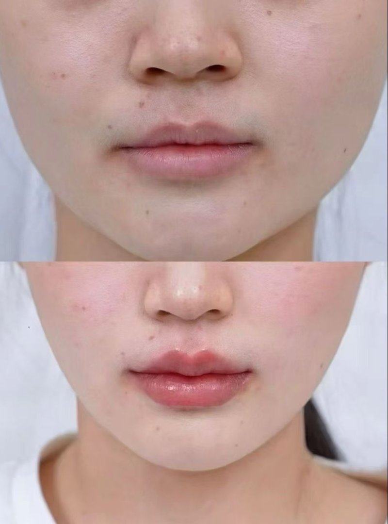 临沂美希整形医院是正规医院吗？