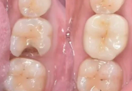 上饶信州区郭芳庆口腔诊所真人口碑评价怎么样？