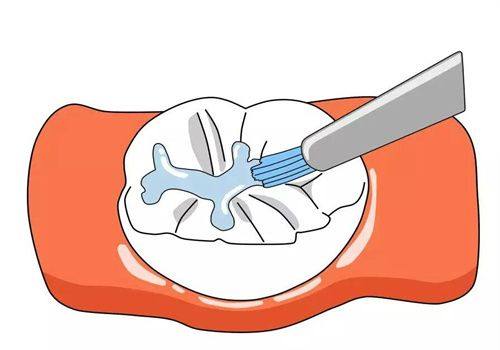 浙江杭州嫚雯美容月雅路口腔诊所特色项目及技术优势