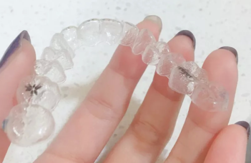 泉州毳生(义华)植发详细的预约挂号方式及流程