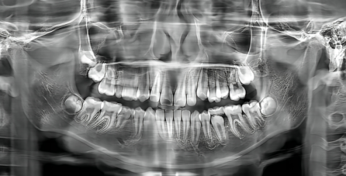 泉州毳生(义华)植发收费价格表/收费标准