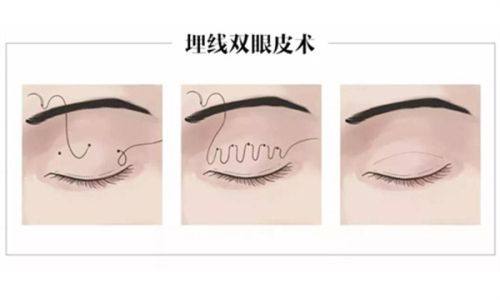 泰州市人民医院烧伤整形科真人口碑评价怎么样？