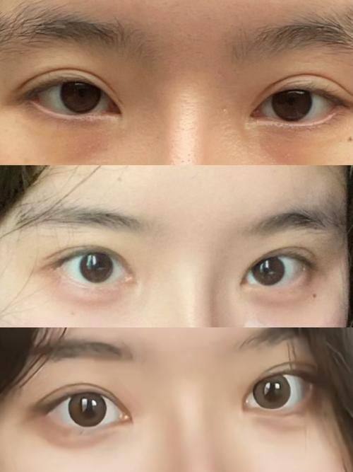 涿州天媛整形科诊所真人口碑评价怎么样？