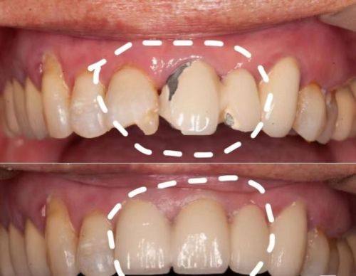 浙江杭州嫚雯美容月雅路口腔诊所详细的预约挂号方式及流程