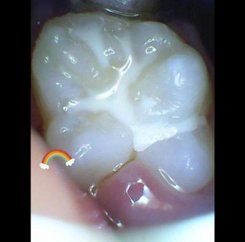 浙江杭州嫚雯美容月雅路口腔诊所收费价格表/收费标准
