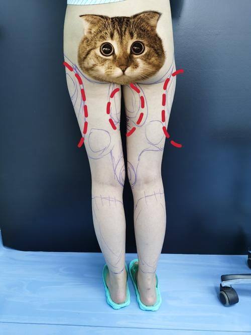 广州美莱医疗美容（华南旗舰院）真人口碑评价怎么样？