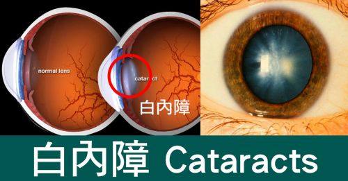 南京市第二医院眼科真人口碑评价怎么样？