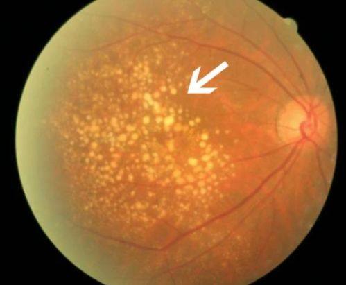 南京市第二医院眼科特色项目及技术优势