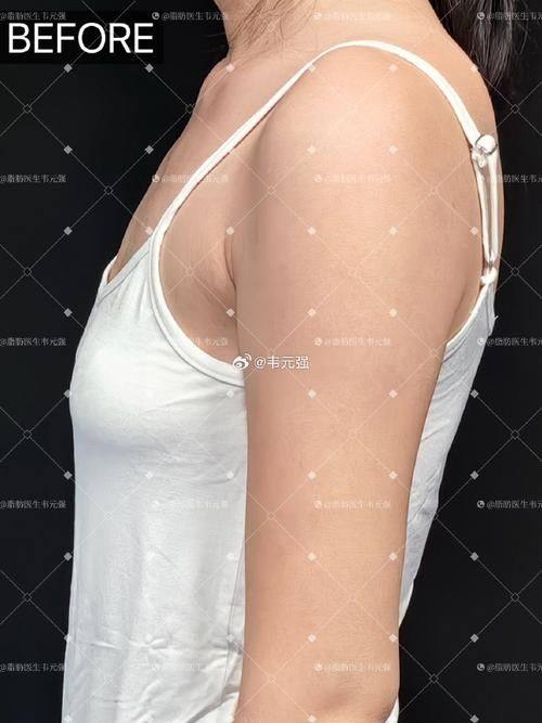 泰州市人民医院烧伤整形科地址电话营业时间