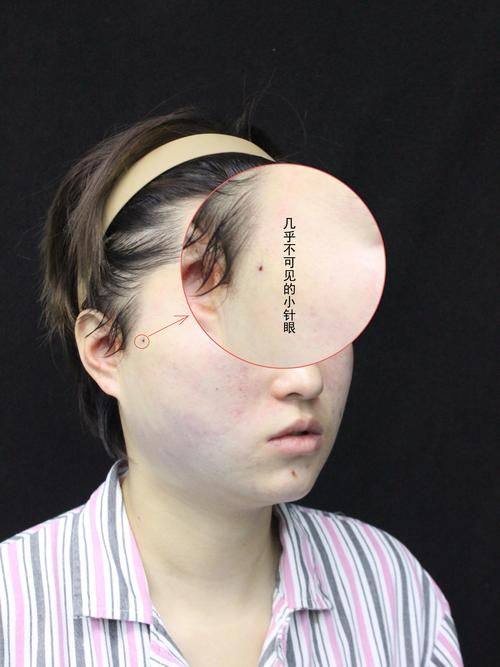 绵阳漾轻心医疗美容诊所真人口碑评价怎么样？