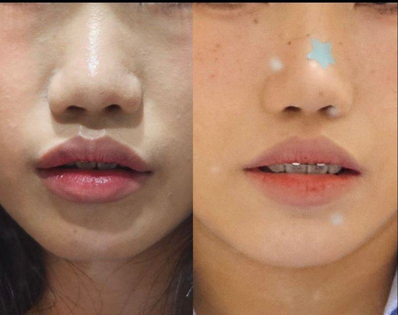 广州美莱医疗美容（华南旗舰院）详细的预约挂号方式及流程