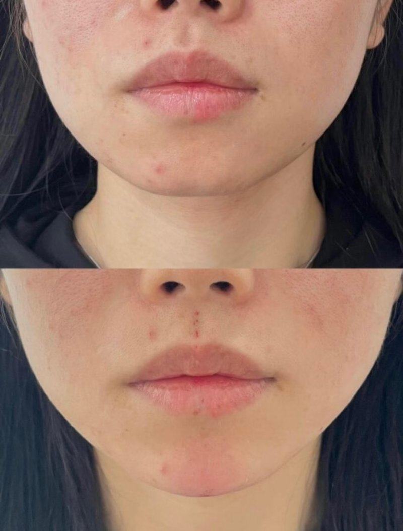 绵阳漾轻心医疗美容诊所是正规医院吗？