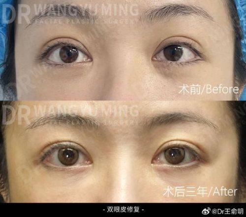 黑龙江艺星医疗美容医院详细的预约挂号方式及流程