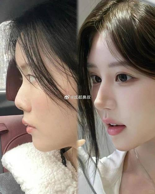 黑龙江艺星医疗美容医院真人口碑评价怎么样？