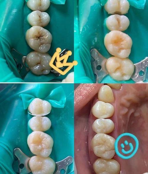 广东深圳唯爱佳口腔真人口碑评价怎么样？