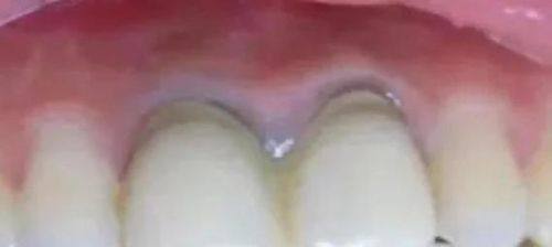 广东深圳唯爱佳口腔特色项目及技术优势