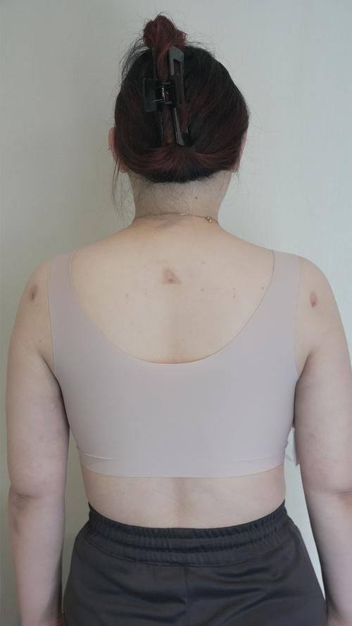 黑龙江艺星医疗美容医院特色项目及技术优势