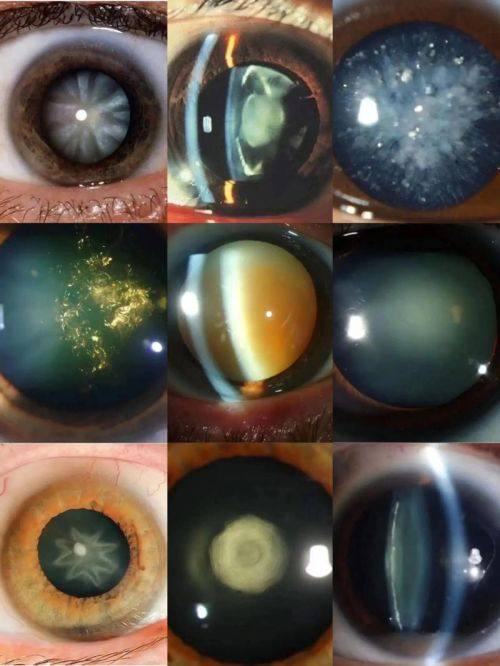 广州华厦维尔视眼科收费价格表/收费标准