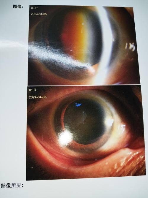 广州华厦维尔视眼科详细的预约挂号方式及流程